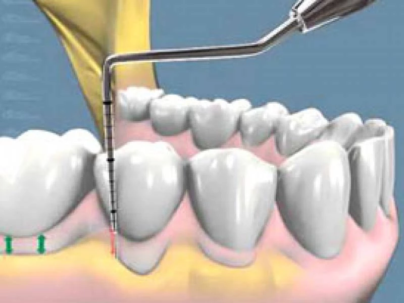 Endodoncia, cirugía e implantes en Dentosalud Las Rozas