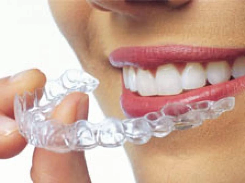 Invisalign en Dentosalud Las Rozas