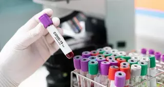 La Comunidad de Madrid inicia las pruebas rápidas de COVID-19 con la entrega de más de 14.000 test en residencias de mayores