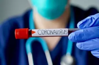 Datos actualizados del número de contagios por Covid19 en Majadahonda