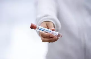 Datos actualizados del número de contagios por Covid19 en Majadahonda