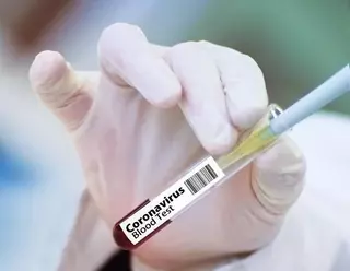Continúa aumentando el número de casos de coronavirus en Majadahonda