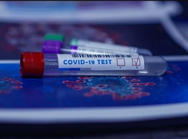 Hoy empiezan a realizarse los test de antígenos a los vecinos de Majadahonda