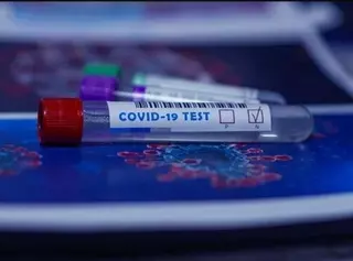 Hoy empiezan a realizarse los test de antígenos a los vecinos de Majadahonda