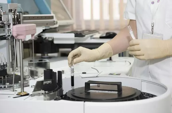 Identificados otros cinco nuevos casos de menores con hepatitis aguda de origen desconocido en la región madrileña